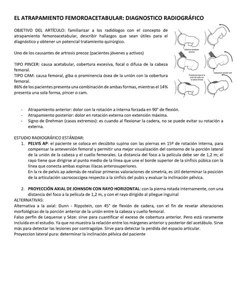 Paper Atrapamiento Femoroacetabular El Atrapamiento Femoroacetabular