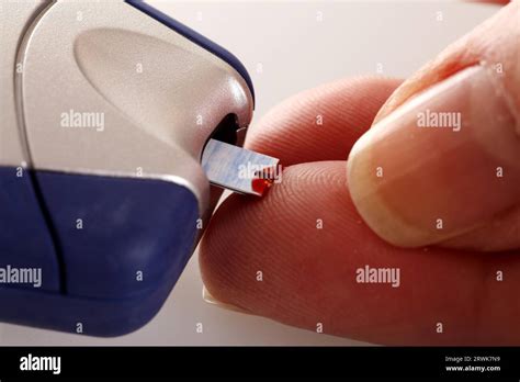 Diabetic Disease Hi Res Stock Photography And Images Alamy