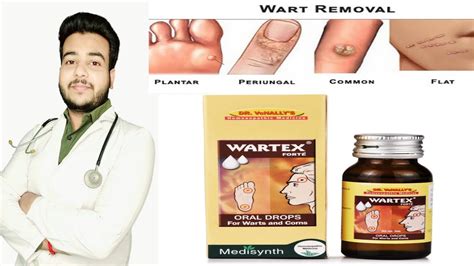 Medisynth Wartex Forte Drop For Warts And Corn Best Homeopathic