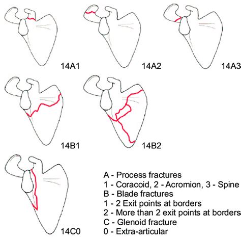 Arbeitsgemeinschaft F R Osteosynthesefragen Ao Extra Articular