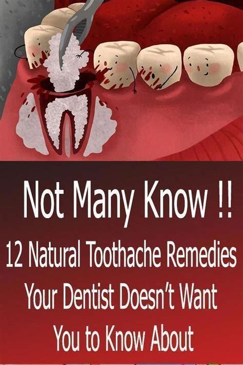 12 Natural Toothache Remedies Your Dentist Doesn’t Want You to Know About