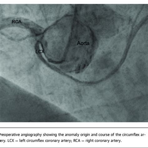 Preoperative Angiogram | Download Scientific Diagram