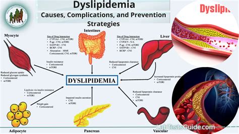 Understanding Dyslipidemia Causes Complications And Prevention