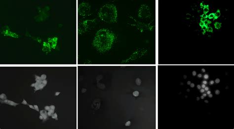 Le Nanoplastiche Alterano Il Microambiente Osseo