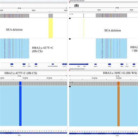 Integrative Genomics Viewer Igv Plots Of Common Deletional Hb H