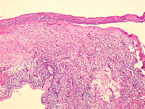 Histopathology Of The Uterine Cervix Digital Atlas