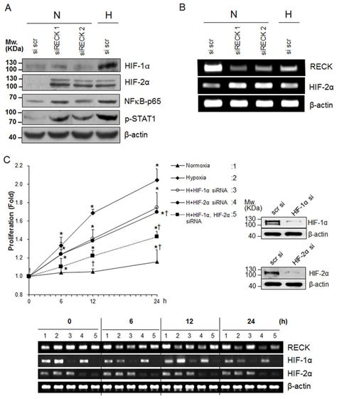 The Involvement Of Hif In Hypoxia Induced Reck Silencing Mediated