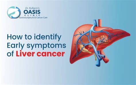 How to Identify Early Symptoms of Liver Cancer | Oasis Clinic