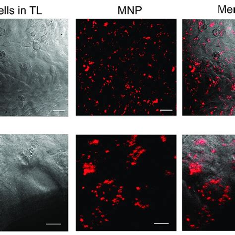 Hela Cancer Cells Loaded With Mnps In Transmitted Light Tl Line A