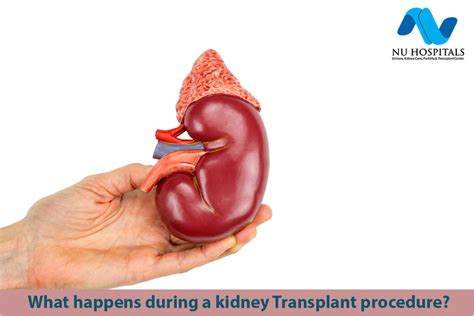 What happens during a kidney transplant procedure?