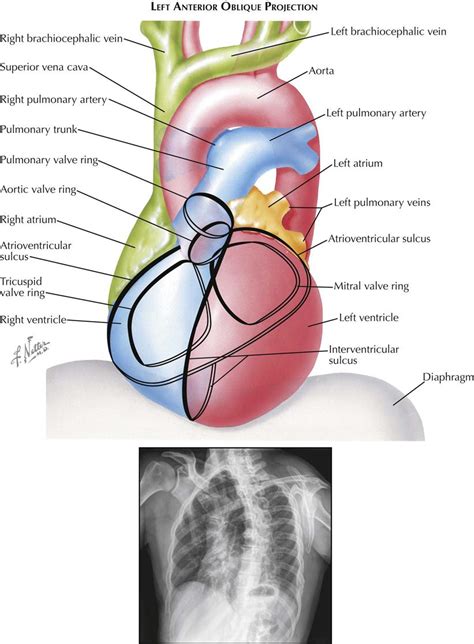 3 Imaging Thoracic Key