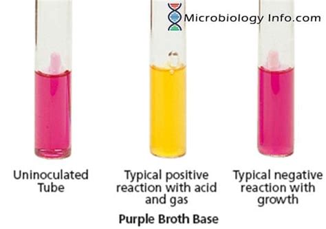 Fermentation Test Principle Procedure Uses And Interpretation