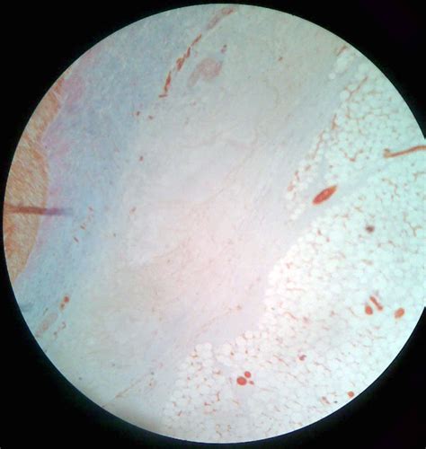 Dense Regular Connective Tissue | howMed Images