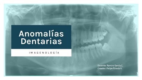 Anomal As Dentarias