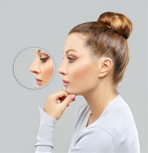 En Savoir Plus Sur La Chirurgie Esth Tique Du Nez La Rhinoplastie