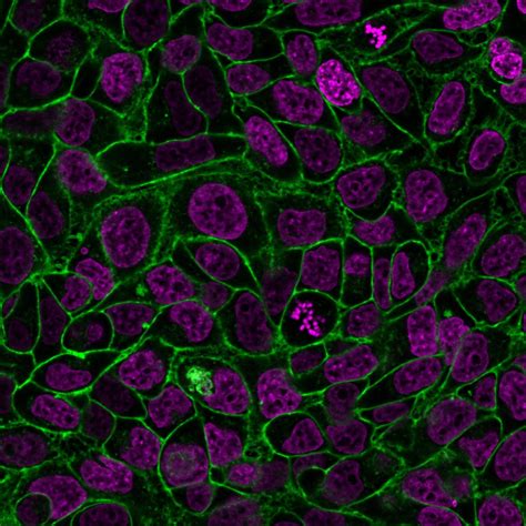 Cellbrite® Steady Membrane Staining Kits Biotium