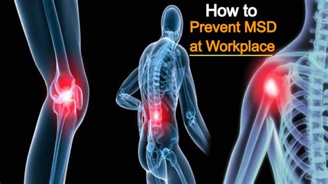 Steps To Minimize Musculoskeletal Disorders At Workplace How To