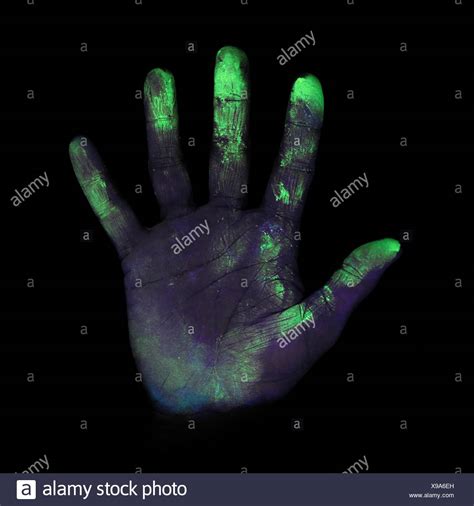 Bacteria On Hand High Resolution Stock Photography And Images Alamy