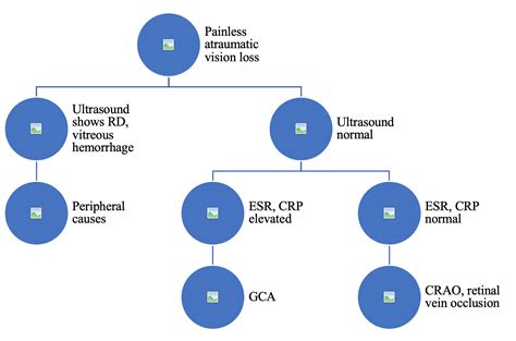 Emergency Medicine Educationcentral Vs Peripheral Vision