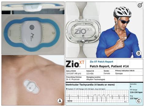 The Role Of Contemporary Wearable And Handheld Devices In The Diagnosis