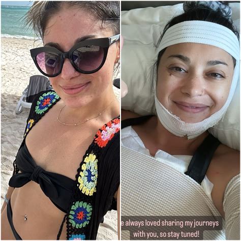 Loren Brovarnik's Plastic Surgery: Before and After Photos | In Touch