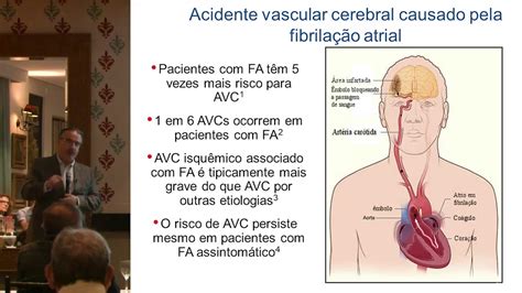 Aula Abcdm Dia 25 04 19 FibrilaÇÃo Atrial DoenÇa Ou Marcador De