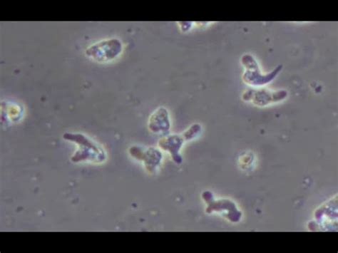 Naegleria Fowleri Under Microscope