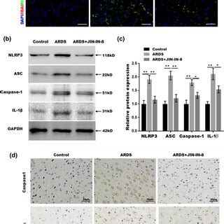 Cjun Nterminal Kinase Jnk Inhibitor Jnkin Improved Acute