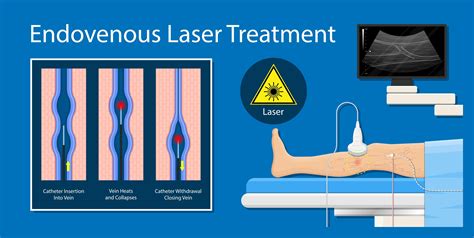 Evlt El Paso Tx Imaging Interventional Specialists