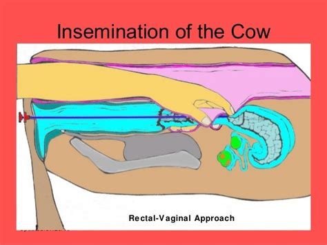 Artificial Insemination