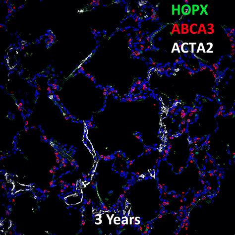 Year Human Lung Hopx Abca And Acta Confocal Imaging