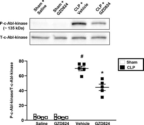 C Abl Kinase Regulates Neutrophil Extracellular Trap Formation And Lung