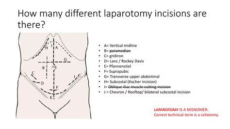 Laparotomy Opening And Closing Ppt