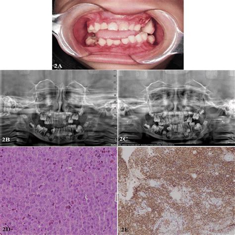 Case 2 Presentation A Preoperative Frontal Clinical Photograph Showing