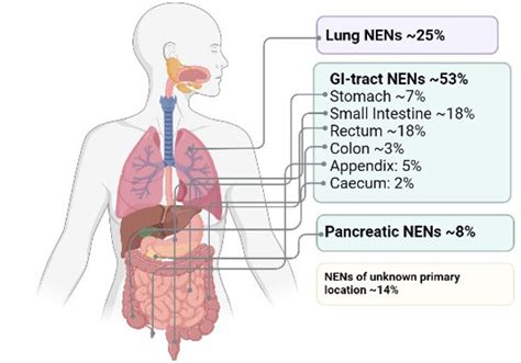 Figure 1. [Occurrence of the most common...]. - Endotext - NCBI Bookshelf