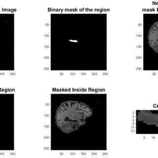 Segmentation of hippocampus from brain MRI | Download Scientific Diagram