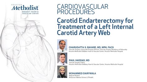 Carotid Endarterectomy For Treatment Of A Left Internal Carotid Artery