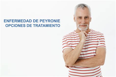 Tratamiento De Enfermedad De Peyronie Posibilidades De Tratamiento