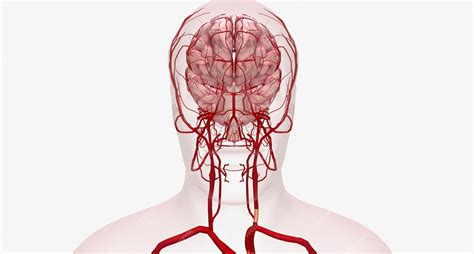 Premium Photo Carotid Artery Stenosis Is The Narrowing Of Arteries