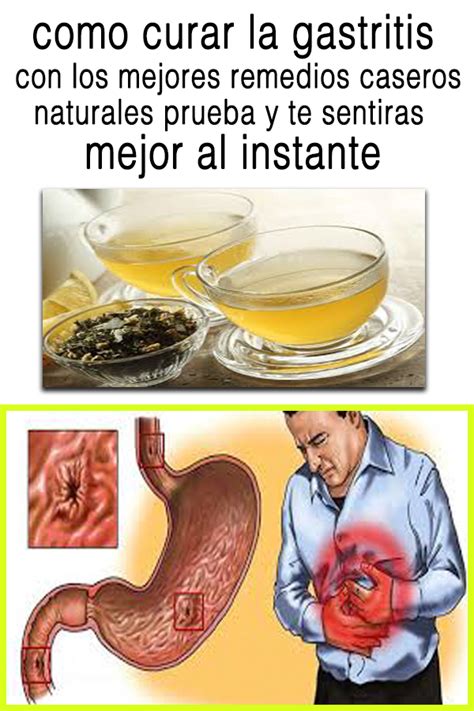 Como Curar La Gastritis Con Los Mejores Remedios Caseros Naturales