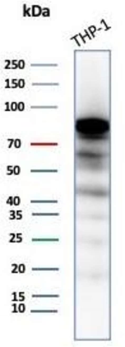 SATB2 Antibody SATB2 8264R Novus Biologicals 100 μg Unconjugated