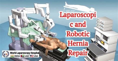 Laparoscopic And Robotic Hernia Repair Tap Tepp And Other