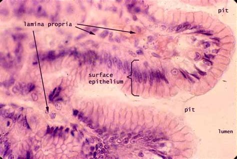 Goblet Cells In Stomach