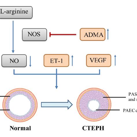 The Pathophysiology Of Cteph Abbreviation Cteph Chronic