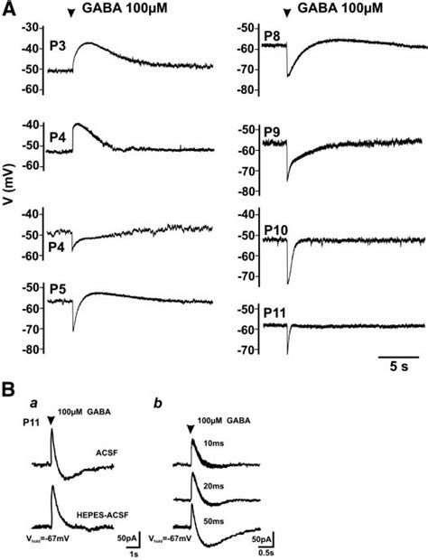 A Developmental Changes Of The Gaba Effects On Sbc Somatic Gramicidin