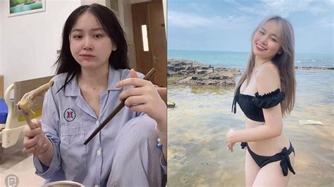 Mặt mộc sau khi nhập viện vì hóa công chúa bong bóng của hot Tiktoker khiến cư dân mạng tá hỏa