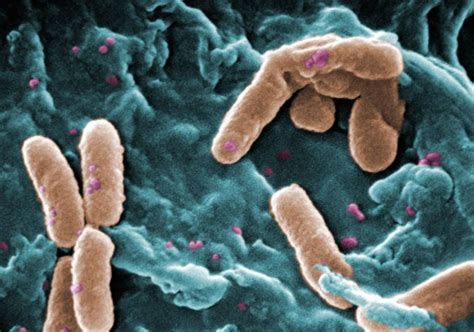 Descubren Un Mecanismo Que Reduce El Material Con El Que Las Bacterias