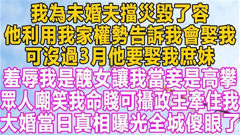 我為未婚夫擋災毀了容，他利用我家權勢告訴我會娶我，可沒過3月他要娶我庶妹，羞辱我是醜女讓我當妾是高攀，眾人嘲笑我命賤可攝政王牽住我，大婚當日真相曝光全城傻眼了！ 故事 小说 分享 愛情