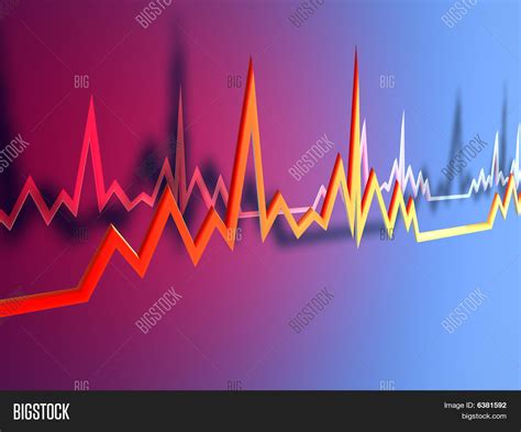 Ekg Lines Image And Photo Free Trial Bigstock