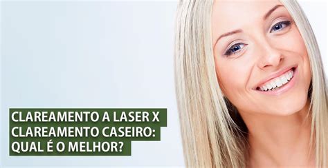 Clareamento Dental A Laser X Clareamento Caseiro Qual O Melhor